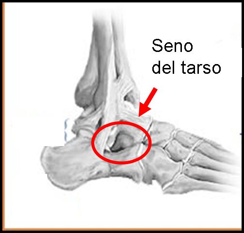 Mama-de-tarsal