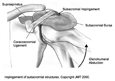 bursa_subacromial