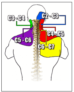 cervical_metameria