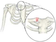 esternoclavicular