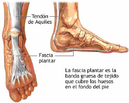 fascia-plantar