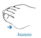 juanete