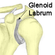 labrum_glenoideo