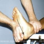 masaje-fascia-plantar