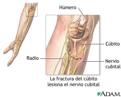 nervio_cubital